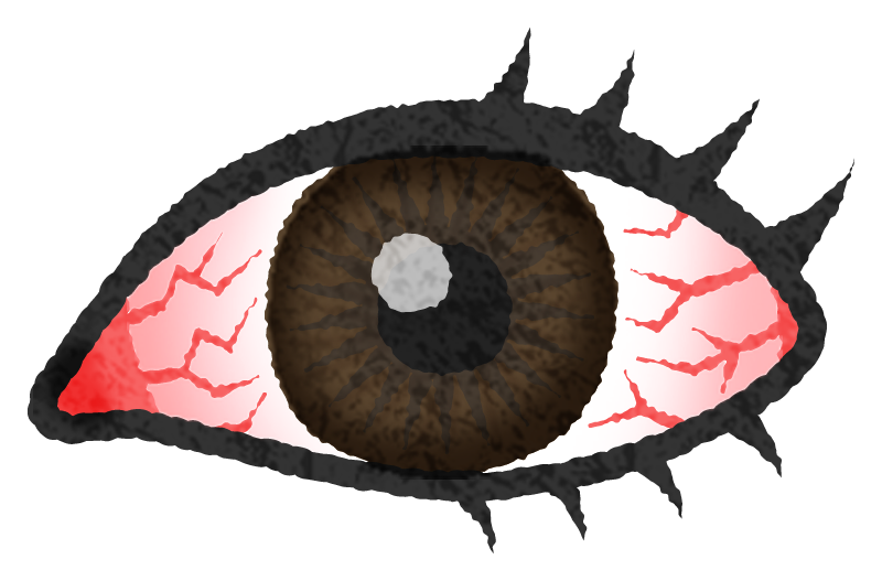 Bloodshot eyes / Red eyes