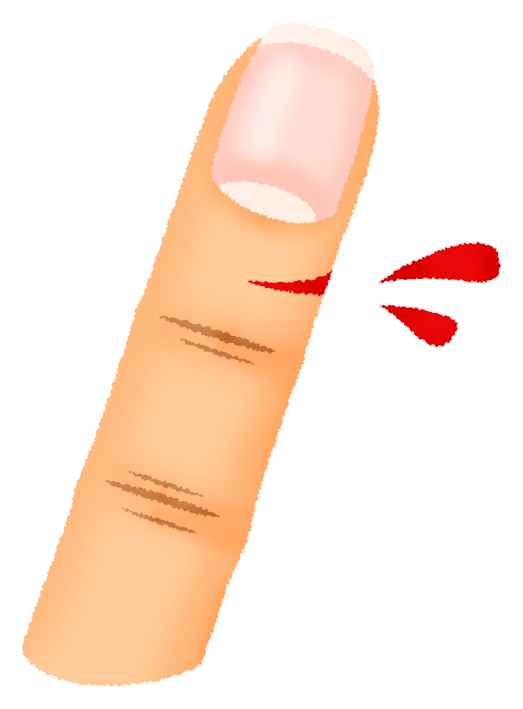 怪我した指（切り傷）のかわいいフリーイラスト素材