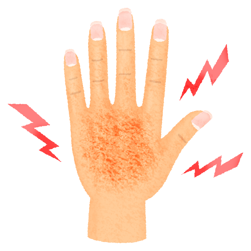 Rough hand (female hand)