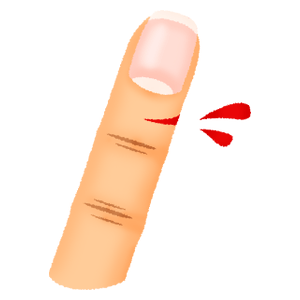 怪我した指（切り傷）
